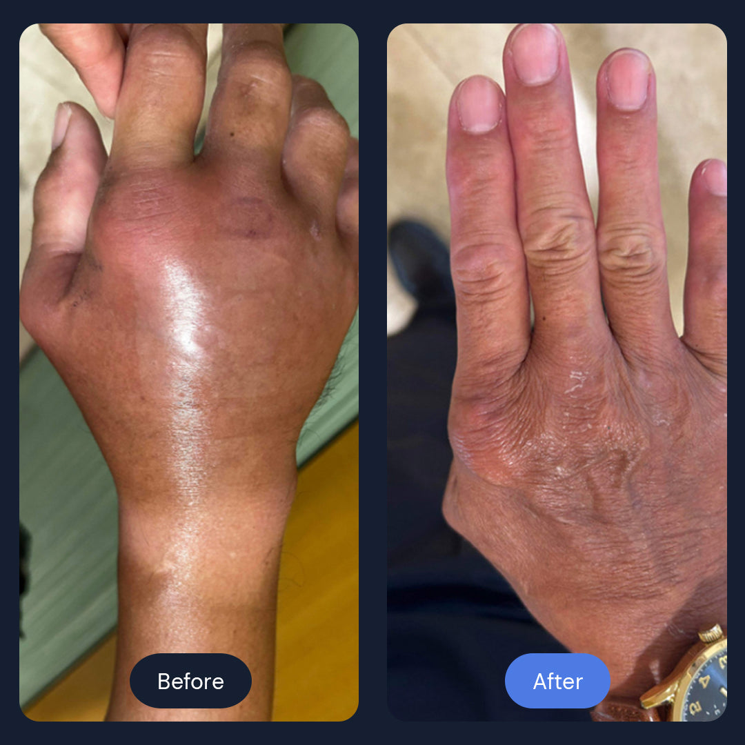 Cryo Recovery | Targeted Cold Therapy for Pain & Inflammation