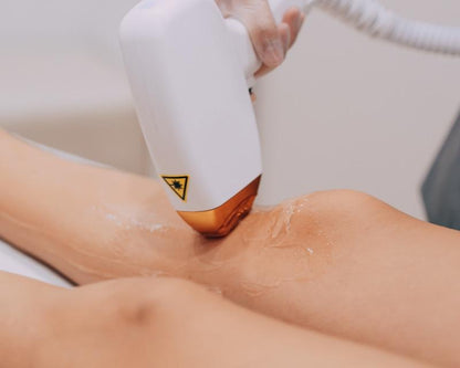 Laser Hair Removal