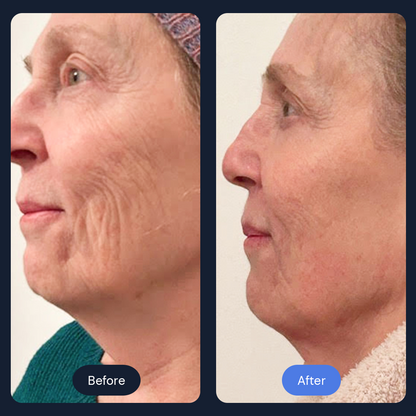 Ritual Cryo Facial | Cold Therapy Skin Rejuvenation