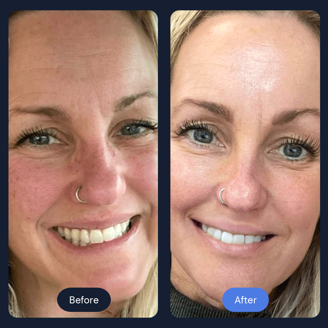 Ritual Cryo Facial | Cold Therapy Skin Rejuvenation