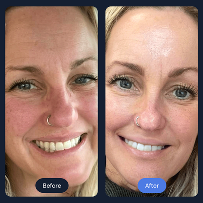 Ritual Cryo Facial | Cold Therapy Skin Rejuvenation