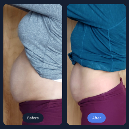 Cryo Sculpt | Targeted Body Contouring with Cold Therapy
