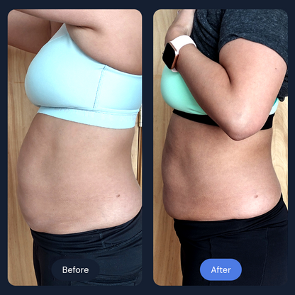 Cryo Sculpt | Targeted Body Contouring with Cold Therapy