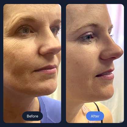 Cryo Lift | Firming Face, Neck & Décolleté Treatment