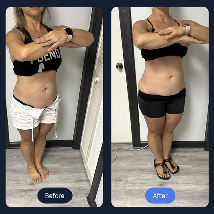 Cryo Sculpt | Targeted Body Contouring with Cold Therapy