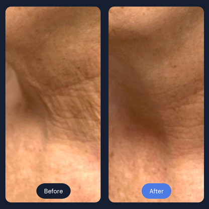 Cryo Lift | Firming Face, Neck & Décolleté Treatment