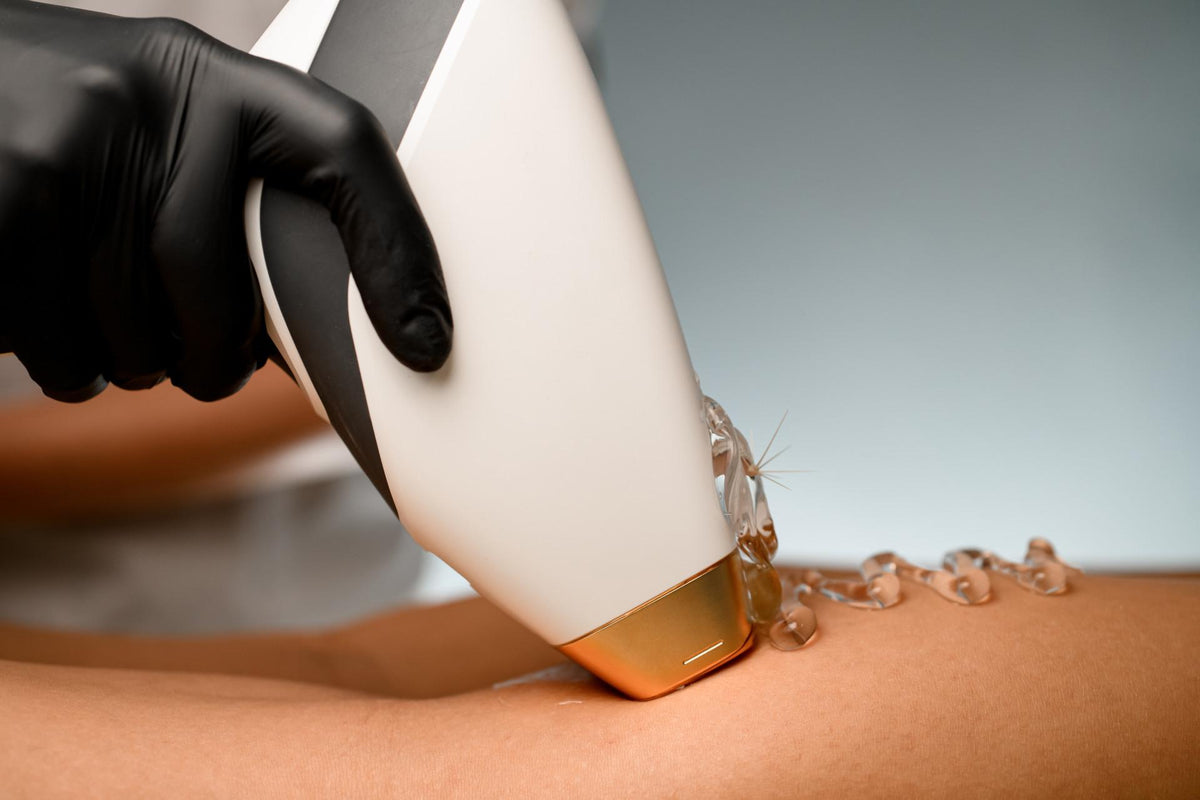 Laser Hair Removal