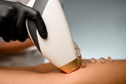 Laser Hair Removal